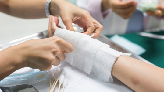 Bandaged hand after burn injury at home